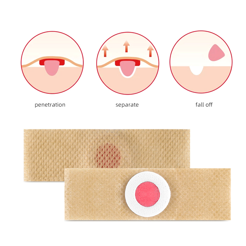 6개입 발 관리 스티커 패치 제거 패드 치료 패치 굳은 - Detox Foot Patch 리뷰 및 가격
